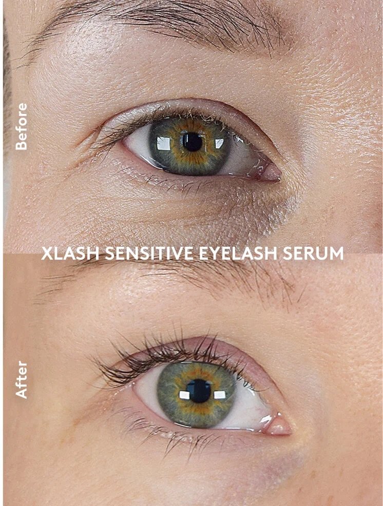 Xlash Sensitive Eyelash Serum (3 ml)