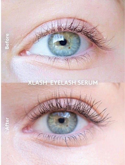 Xlash Eyelash Serum (1 ml)